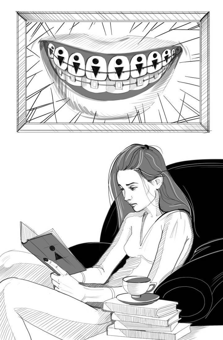 Брекеты